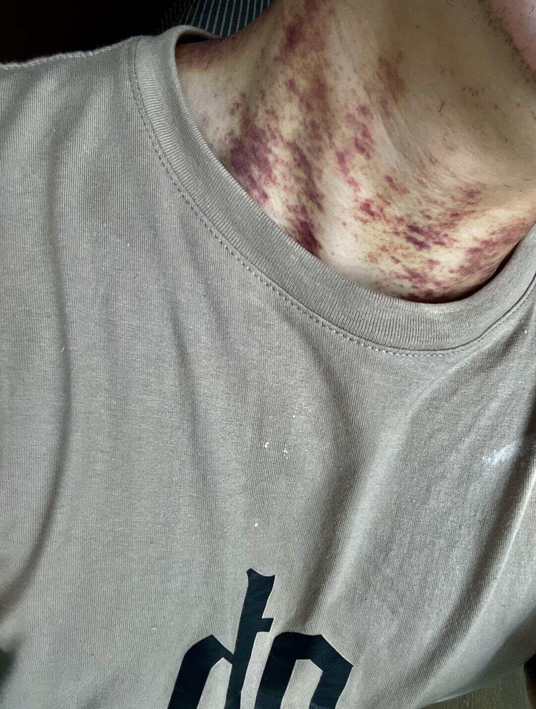 男子称住进月租6万甲醛房患病房东回应：交房已5年或是租客自购家具所致(图4)