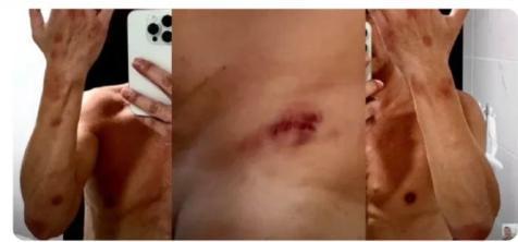 57岁男星2次被友人迷奸导致肾衰竭需终身洗肾他还要道歉赔偿(图8)