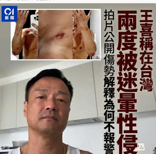 57岁男星2次被友人迷奸导致肾衰竭需终身洗肾他还要道歉赔偿(图12)